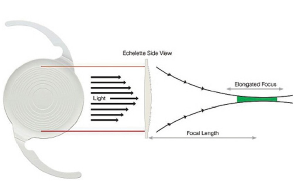 Extended Depth-of-Field